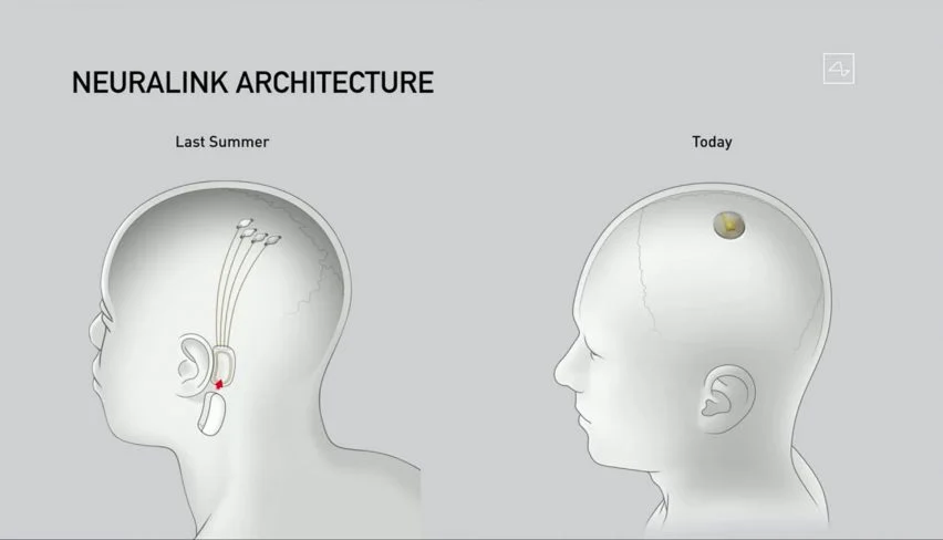 neuralink-update-elon-musk-technology.webp